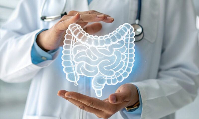 Cáncer de colon