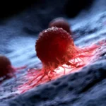 Qué es el cáncer