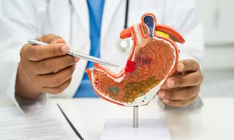 cáncer de estómago