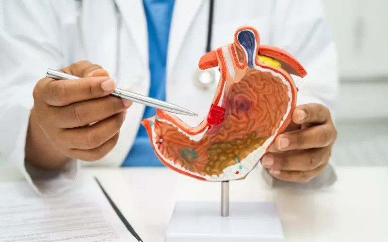 cáncer de estómago