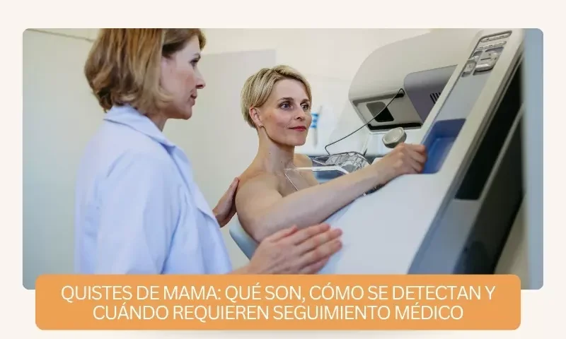 quistes de mama