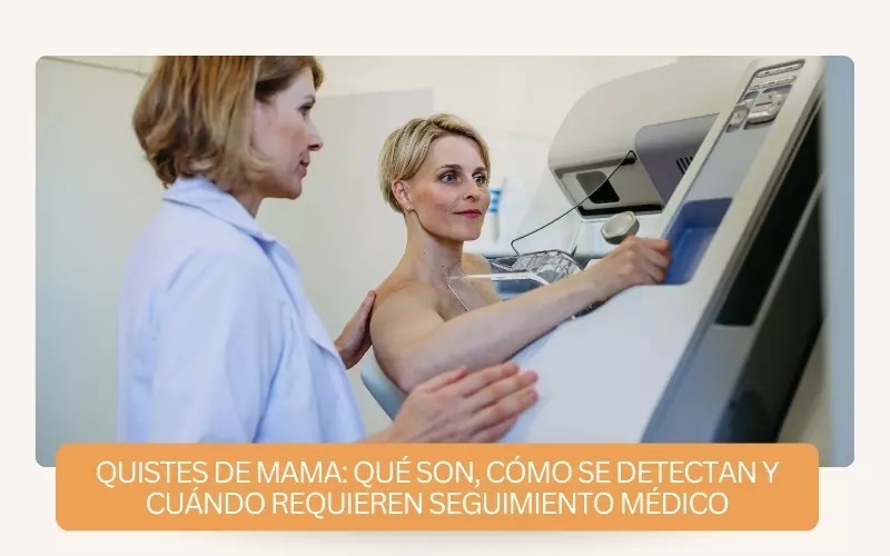 quistes de mama