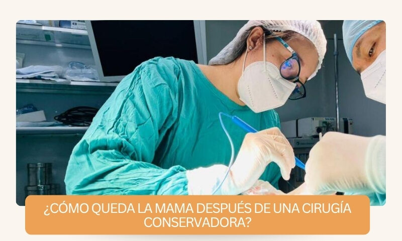 cómo queda la mama después de una cirugía conservadora